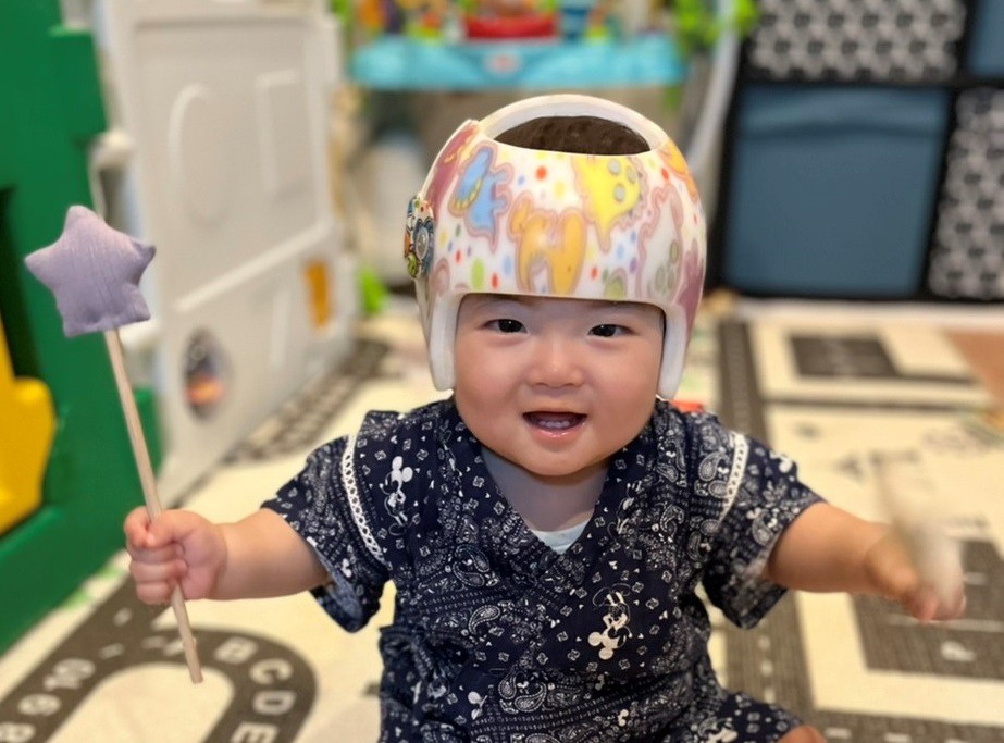 星の子だより 赤ちゃんの頭の矯正ヘルメットならスターバンド Ahs Japan Corporation
